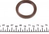 559 0028 30 INA (Germany) Комплект ланцюга приводу розподільного валу (пр-во INA) (фото 13)